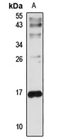 Hemoglobin beta Antibody