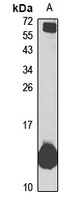 HBZ Rabbit Polyclonal Antibody