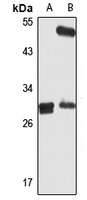 HDGFRP3 Rabbit Polyclonal Antibody