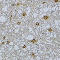 HDGFRP3 Rabbit Polyclonal Antibody