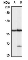 HEL308 Rabbit Polyclonal Antibody