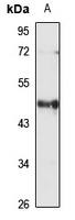 HLA-F Rabbit Polyclonal Antibody
