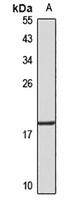 HMGA2 Rabbit Polyclonal Antibody