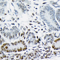 HMGA2 Rabbit Polyclonal Antibody