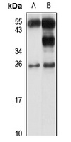 HMGB3 Rabbit Polyclonal Antibody