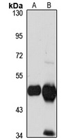 HMGCS2 Antibody