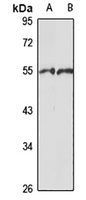 hnRNP H1 Rabbit Polyclonal Antibody