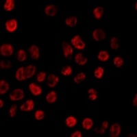 hnRNP H1 Rabbit Polyclonal Antibody