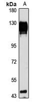 hnRNP U Rabbit Polyclonal Antibody