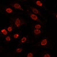 hnRNP U Rabbit Polyclonal Antibody