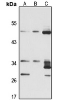 HSD17B6 Rabbit Polyclonal Antibody