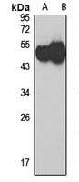 HYAL1 Rabbit Polyclonal Antibody