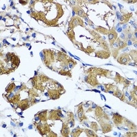 HYAL1 Rabbit Polyclonal Antibody