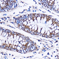 ICA1 Antibody