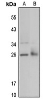 IDI1 Rabbit Polyclonal Antibody