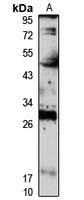IDI2 Rabbit Polyclonal Antibody