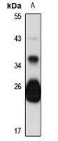 GILT Antibody