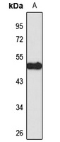 IFIT2 Rabbit Polyclonal Antibody