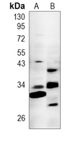 IGFBP6 Antibody