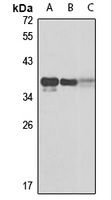 IGFBP7 Rabbit Polyclonal Antibody