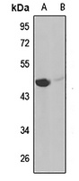 IL-11RA Antibody