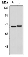 IL-22R Antibody