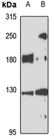INF2 Rabbit Polyclonal Antibody