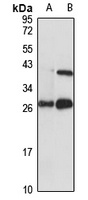 INSIG2 Rabbit Polyclonal Antibody