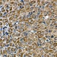 INSIG2 Rabbit Polyclonal Antibody