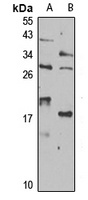 ISCU Rabbit Polyclonal Antibody