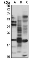ISG20 Rabbit Polyclonal Antibody