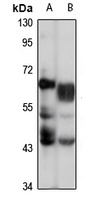 ISYNA1 Rabbit Polyclonal Antibody