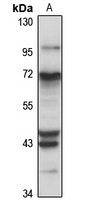 ITCH Rabbit Polyclonal Antibody