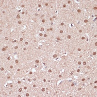 ITCH Rabbit Polyclonal Antibody