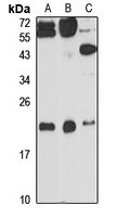 ITPase Rabbit Polyclonal Antibody