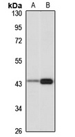 IVD Rabbit Polyclonal Antibody