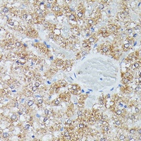 IVD Rabbit Polyclonal Antibody
