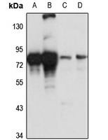 LysRS Rabbit Polyclonal Antibody