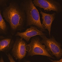 LysRS Rabbit Polyclonal Antibody