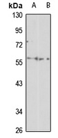 KAT8 Rabbit Polyclonal Antibody