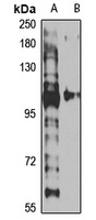 KDM4B Antibody