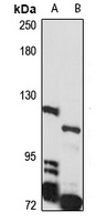 JMJD2C Rabbit Polyclonal Antibody