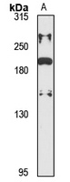 KIF21A Rabbit Polyclonal Antibody