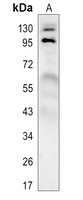 MKLP1 Rabbit Polyclonal Antibody