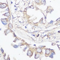 Klotho Rabbit Polyclonal Antibody