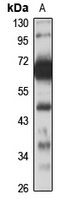 KLF6 Antibody