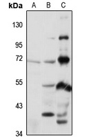 KLHL41 Rabbit Polyclonal Antibody