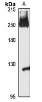 KNTC1 Rabbit Polyclonal Antibody
