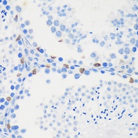 LARP2 Rabbit Polyclonal Antibody