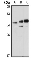 LDHC Rabbit Polyclonal Antibody